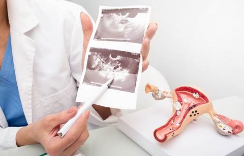 Ultrassom Ginecológico: Exame De Rotina Pode Identificar Doenças Graves, Mesmo Sem Sintomas